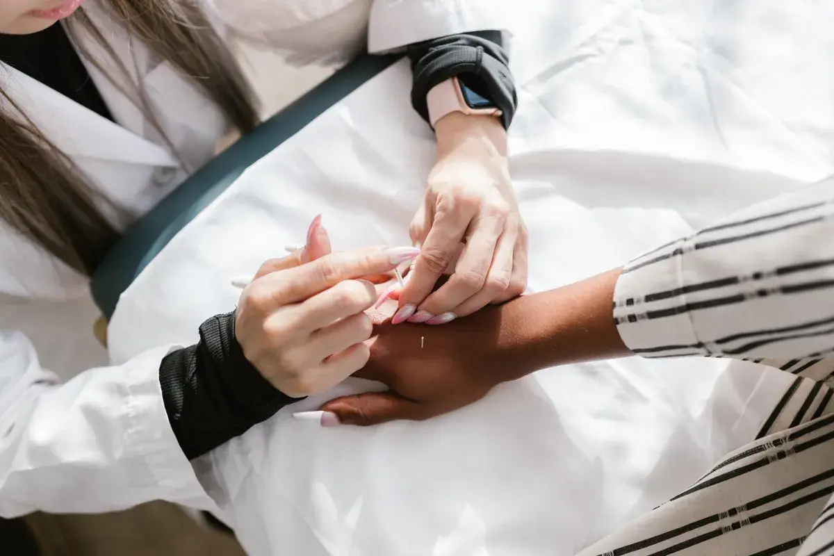 Healthcare provider inserting a thin needle into a patient's hand during acupuncture treatment