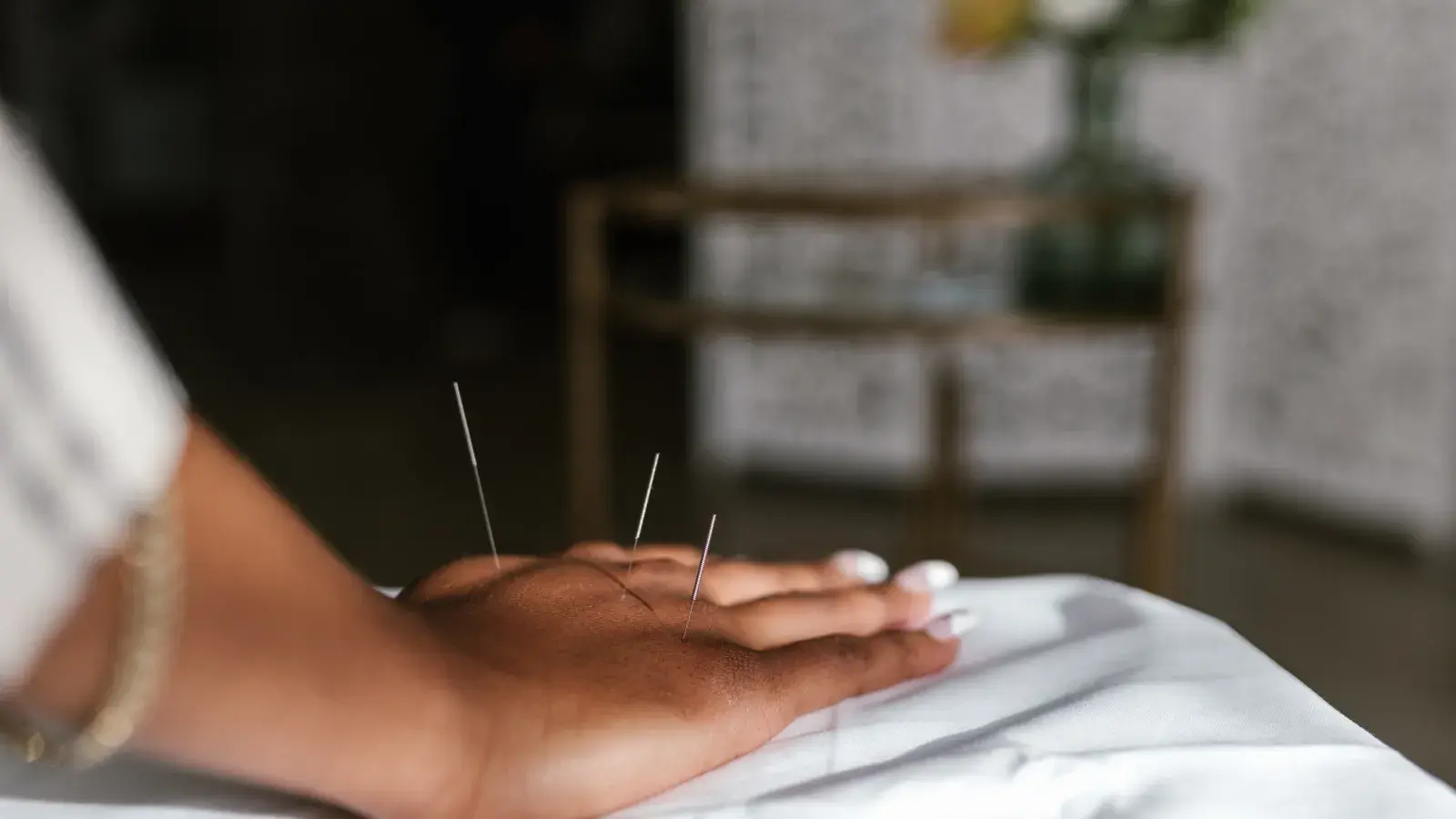 Acupuncture for Stress Relief: What a Session Feels Like