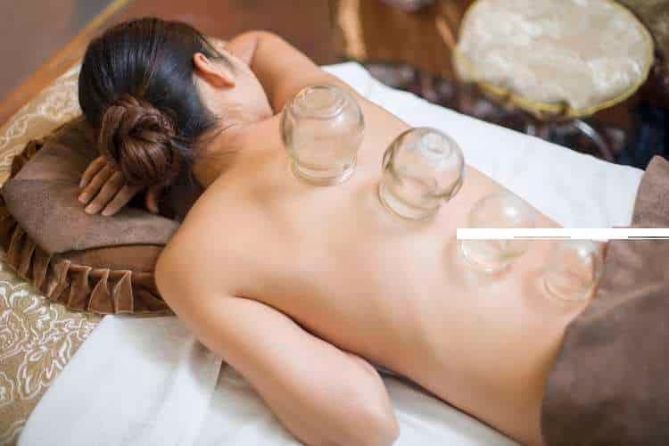Woman lying face down with glass cups on her back