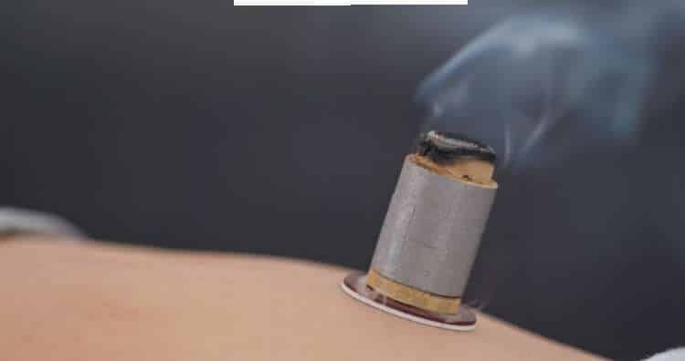Close-up of a moxa cone burning on the skin