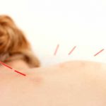 acupuncture to get menstruation back