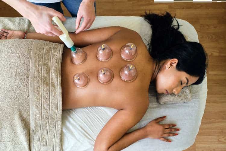 woman getting suction cupping
