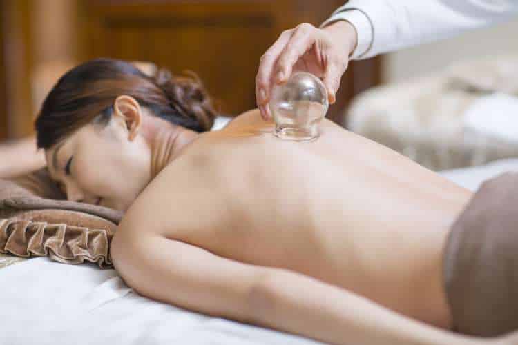 woman getting moving chinese medicine cupping