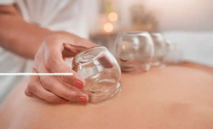 Cupping 3