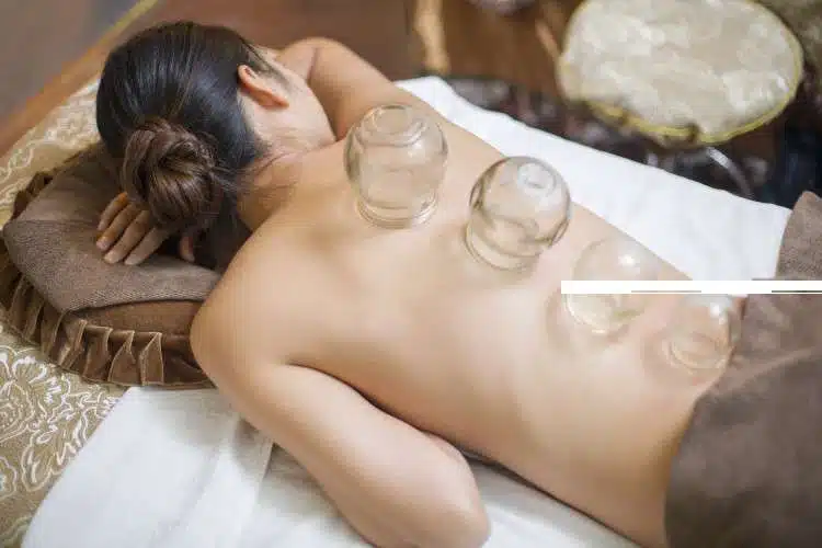 Cupping 6
