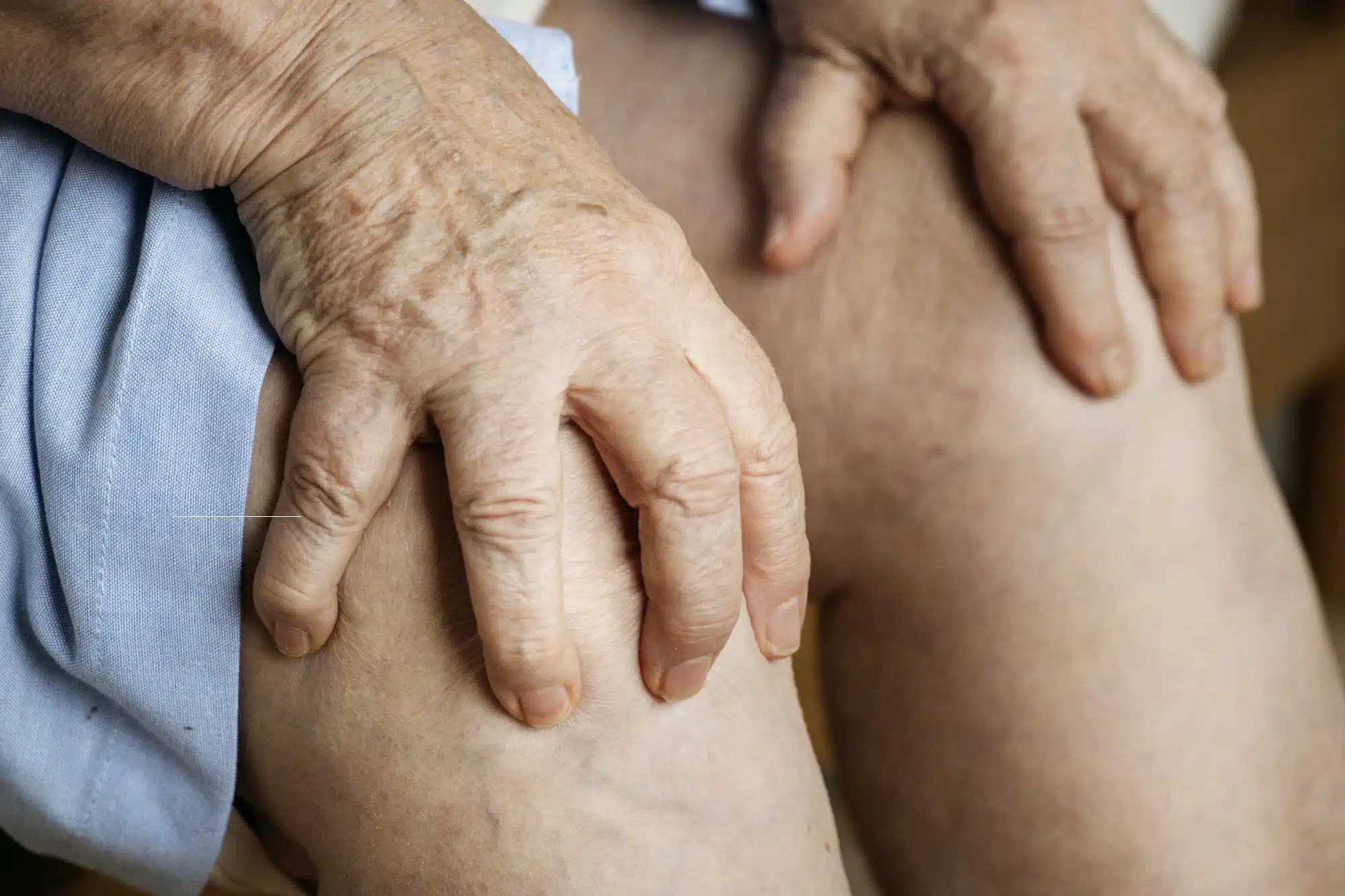 Knee Acupuncture in Keswick 1 Elderly woman holding their knees before getting knee acupuncture in keswick